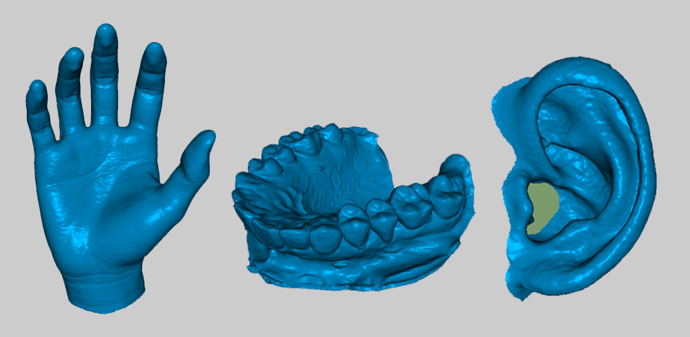 Moose on the Medical Frontier: Reinventing Prosthetics and Assistive Devices