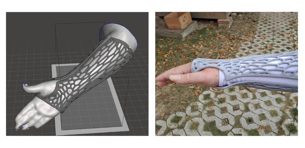 Innovating Prosthetics: Imrich Molnár's Journey with the Mole 3D Scanner